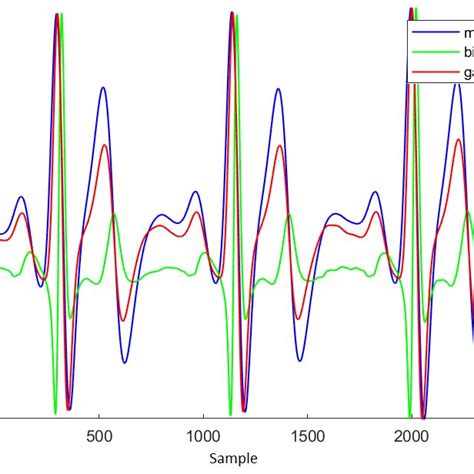 Reconstructed Ecg Signal Using Wavelet Thresholding Method Over