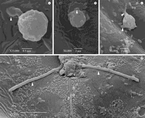 Scanning electron microscopy of Stomoxys calcitrans larvae exposed to ...