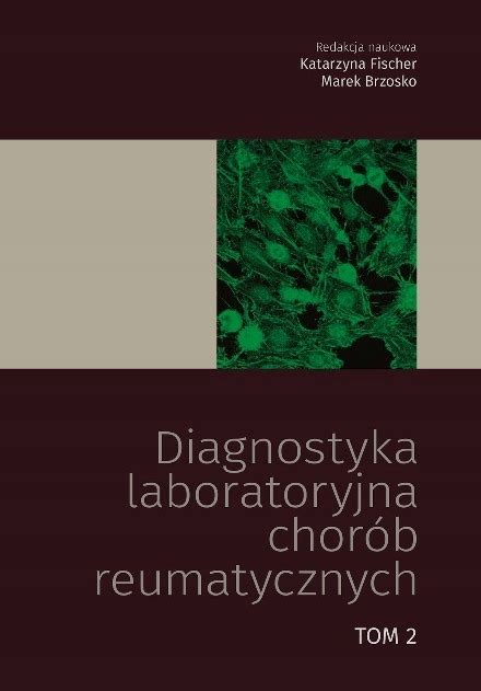 Diagnostyka laboratoryjna chorób reumatycznych 13301578324 Książka