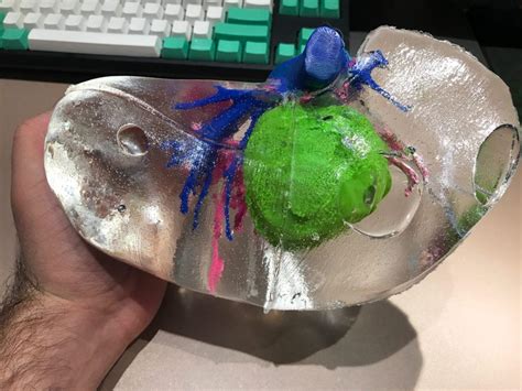 Medical Student Creates Patient-Specific 3D Printed Liver Model for Less Than $150 - 3DPrint.com ...