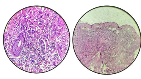 SOLUTION Unap L Minas Descritas De Anatom A Patol Gica Neoplasias