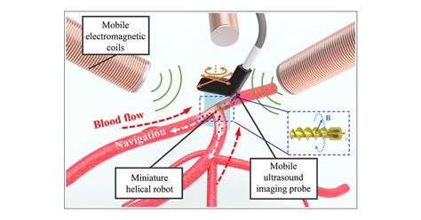 Real Time Ultrasound Doppler Tracking And Autonomous Navigation Of A