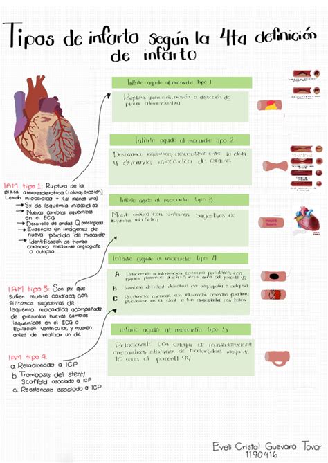 Tipos De Infarto De Acuerdo A La Cuarta Definici N De Infarto Tipos