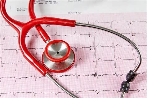 What Causes AFib? A Heart Doctor Lists 5 Surprising Triggers | The ...