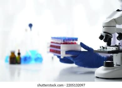 Lab Worker Preparing Test Blood Detection Stock Photo 2205132097