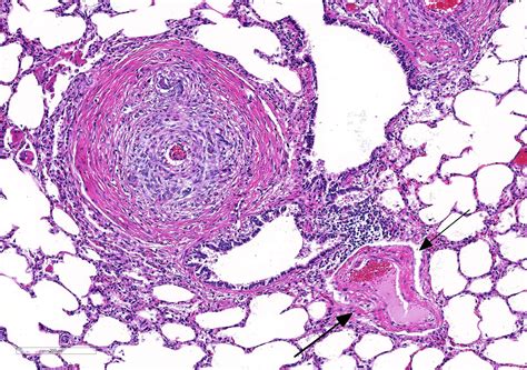 Pulmonary Artery Histology