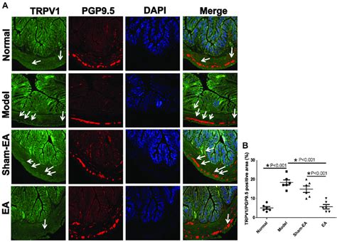 Effects Of EA On The Expressions Of TRPV1 Green And PGP 9 5 Red In