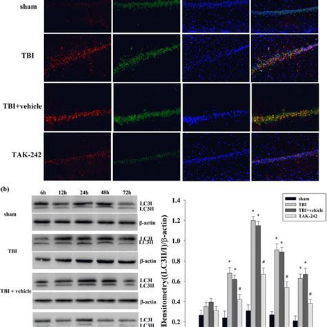 The Effect Of Tak On Neuronal Autophagy A Co Localization Of Lc