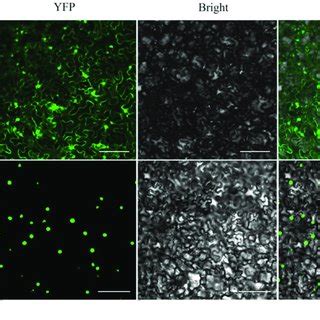 Subcellular Localization Of MfWRKY41 In Tobacco Epidermis Fluorescence