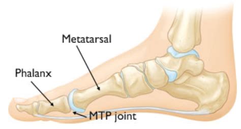 Hallux Rigidus Liverpool Foot Centre