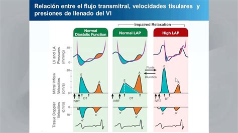 Lv Diastolic Dysfunction Ase | IUCN Water