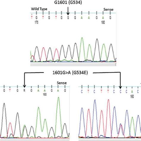 Sequence Chromatograms Showing A Normal Sequence Of A Segment Of Exon