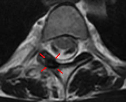 Radiology Quiz Radiopaedia Org