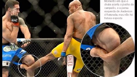 Anderson Silva Quebra Perna Tragedia Youtube