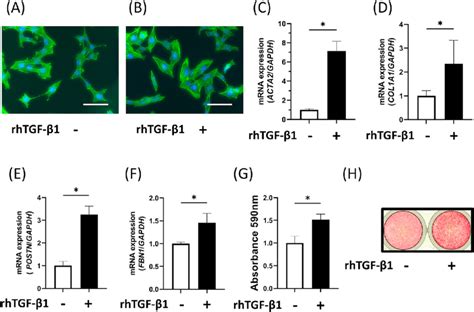 Effects Of Tgf B On Acta And Pdl Related Gene Expression And Collagen