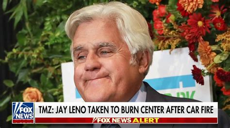 Jay Leno reveals burns from fire, released from hospital | Fox News