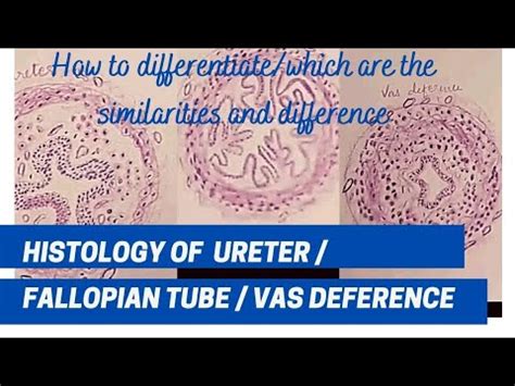 Histology Of Ureter Vas Deference Fallopian Tube Drawing How To