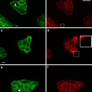 EGF Induced Cell Rounding Of A431 Cells A431 Cells Were Serum Starved