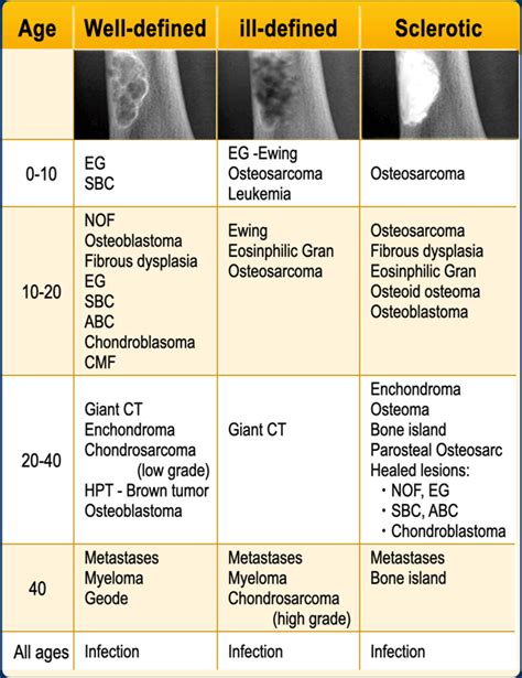 Bone tumor의 영상의학적 접근 방법 네이버 블로그