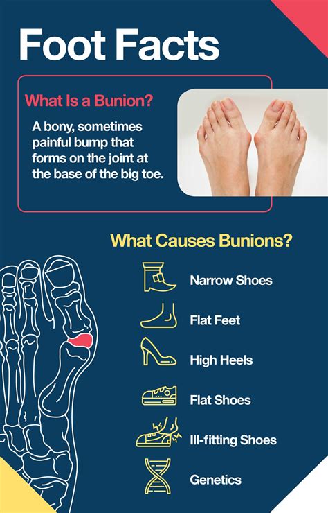 Bunions: Symptoms, Causes, Diagnosis, And Treatment, 51% OFF