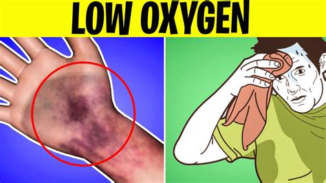 Warning Signs Of Low Oxygen In Your Blood Youtube