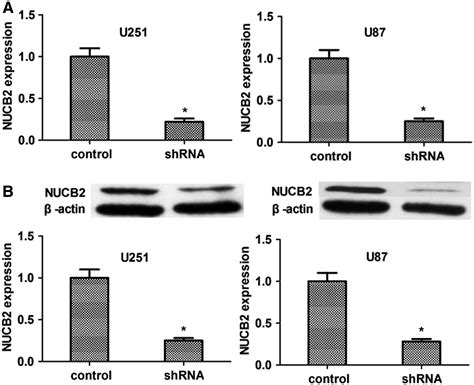 Nucleobindin Promotes The Growth And Invasion Of Glioblastoma