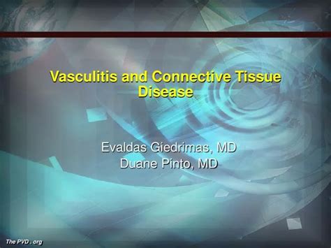 Ppt Vasculitis And Connective Tissue Disease Powerpoint Presentation Id1703684