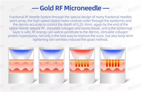 SUNWIN B3317 Gold Microneedling Fractional Rf Wrinkle Removal Machine