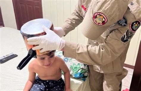 Menino de 4 anos fica a cabeça presa dentro de panela de pressão no