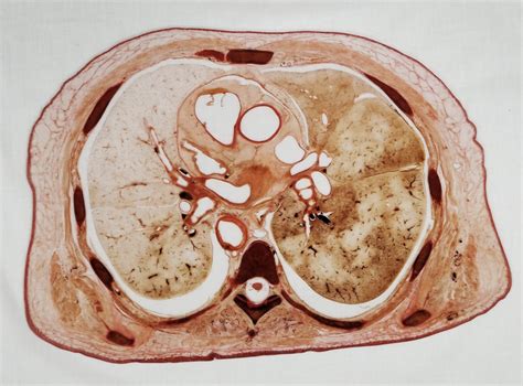 Transverse Cross Section Exam Diagram Quizlet