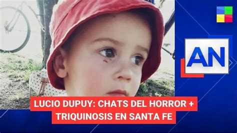 Chats Lucio Dupuy Triquinosis en Santa Fe AméricaNoticias