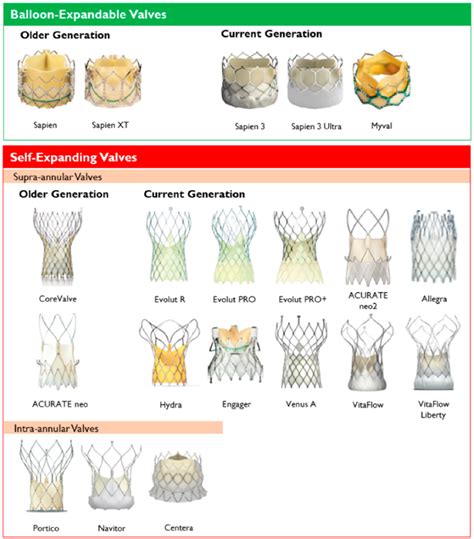 Heart valve simulation shifts the treatment paradigm - StarFish Medical