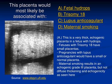 Ppt Placental Us Powerpoint Presentation Free Download Id3356735