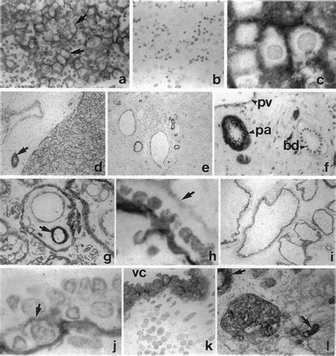 Immunoperoxidase Staining Of Human Tissues With Anti Lu Gp Monoclonal