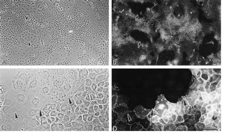 A431 Cells Show Loss Of E Cadherin Staining As They Convert To A431D