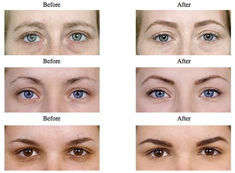 Eyebrow Shaping Adelaide Day Spa Adelaide