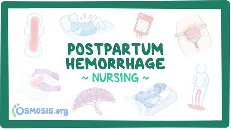 Postpartum Hemorrhage Nursing Video And Causes Osmosis