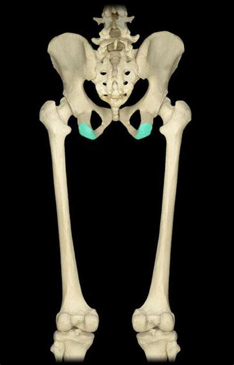 A clear image of the ischial tuberosity, pelvic bone, and the legs ...