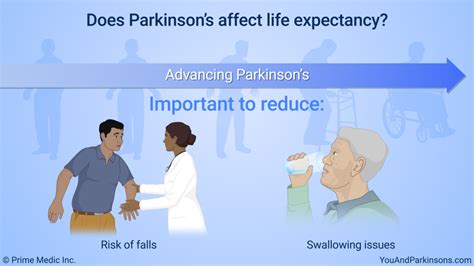 Slide Show Diagnosis Of Parkinsons Disease