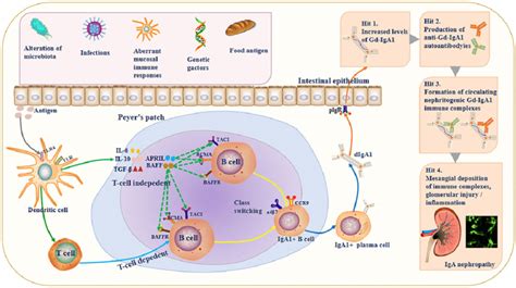 Mucosal Immune Anatomy Of Iga Responses And The Multi Hit Model Of