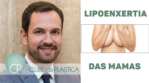 Clube Da Plástica Lipoenxertia Das Mamas Cirurgia Plástica Youtube