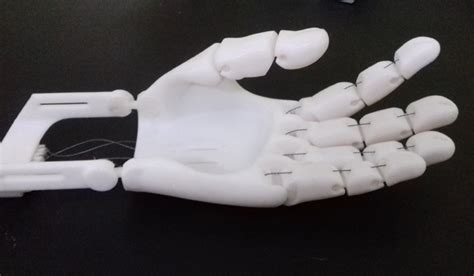 Extending a 3D-printed prosthetic arm of love- The Week