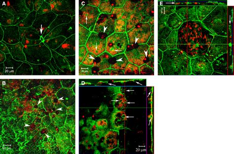 Retinal Pigment Epithelial Cell Multinucleation In The Aging Eye A