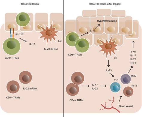 Schematic presenting the mechanism of disease relapse following ...