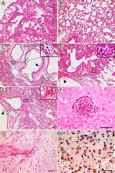 Photomicrographs Of Hematoxylin And Eosin Hande Stained And Download Scientific Diagram