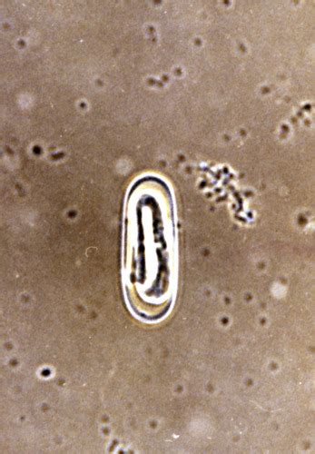 Spirocerca Lupi