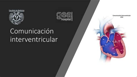 Resúmenes De Comunicación Interventricular Descarga Apuntes De