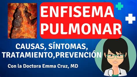 Enfisema Pulmonar 🫁 Todo Lo Que Debes Saber Causas SÍntomas