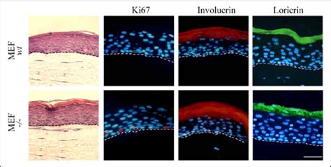 Dermally Derived Perlecan Is Dispensable For Epidermal Formation