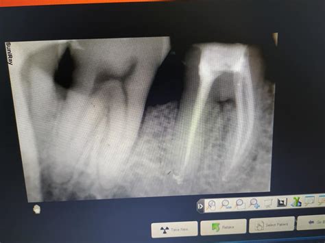 Division of conservative dentistry and endodontics in dept of Dentistry